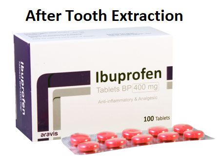 Why No Ibuprofen After Tooth Extraction?